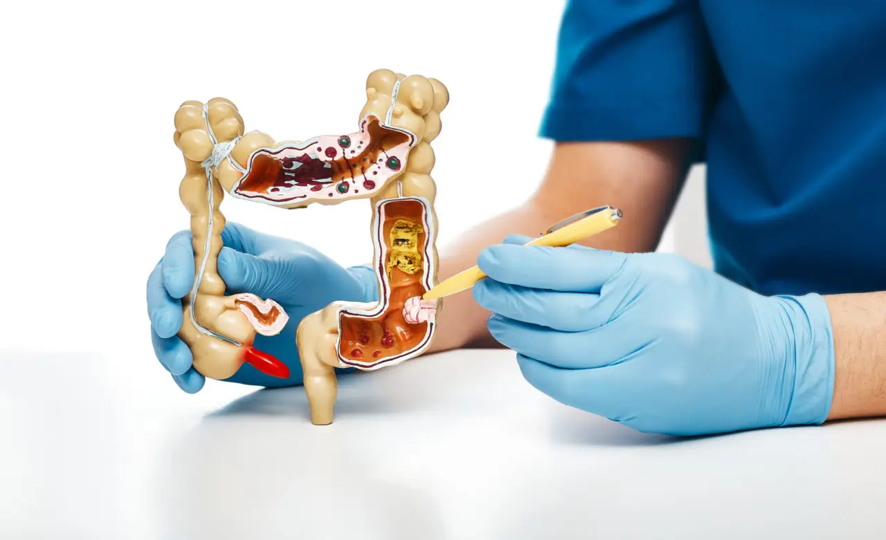 Attenzione: ecco come pulire lo stomaco e l’intestino naturalmente